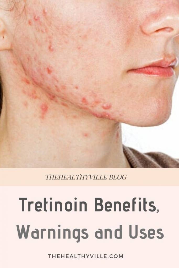 Tretinoin Benefits, Warnings and Uses