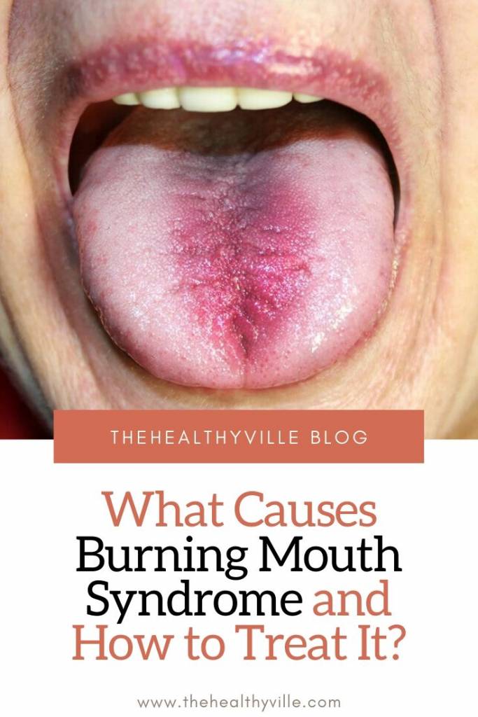 What Causes Burning Mouth Syndrome and How to Treat It_