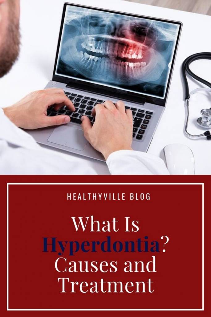 What Is Hyperdontia_ Causes and Treatment