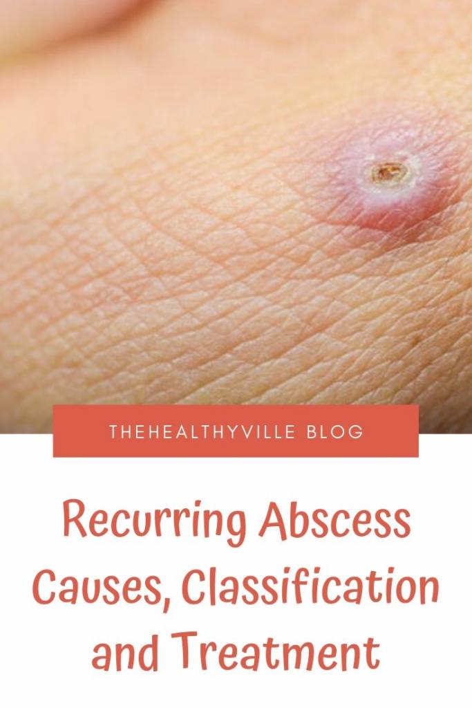 Recurring Abscess Causes, Classification and Treatment