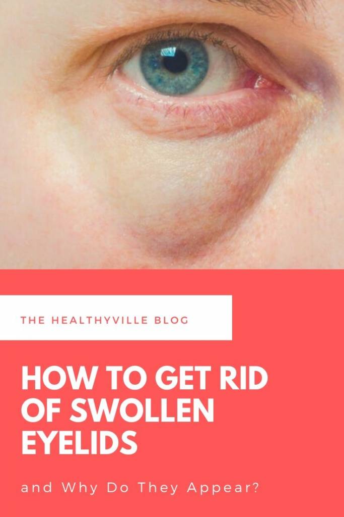 How to Get Rid of Swollen Eyelids and Why Do They Appear_