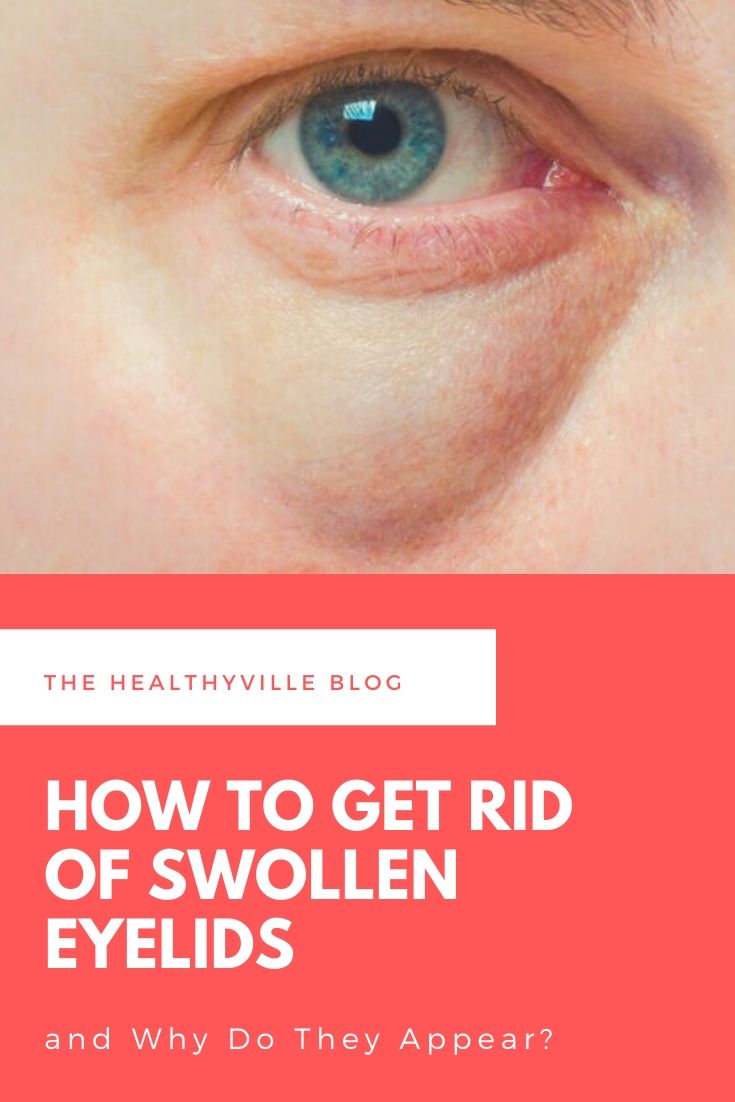 How To Get Rid Of Swollen Eyelids And Why Do They Appear 