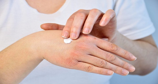How to Heal Dry Cracked Hands During the Winter Season?