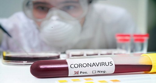 A New Coronavirus Alters the World: What Should You Know about It?