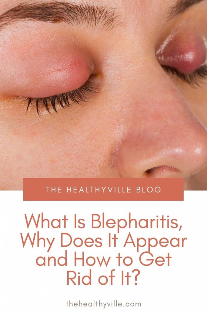 What Is Blepharitis, Why Does It Appear and How to Get Rid of It_