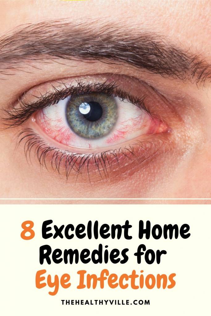 8 Excellent Home Remedies for Eye Infections You Should Use