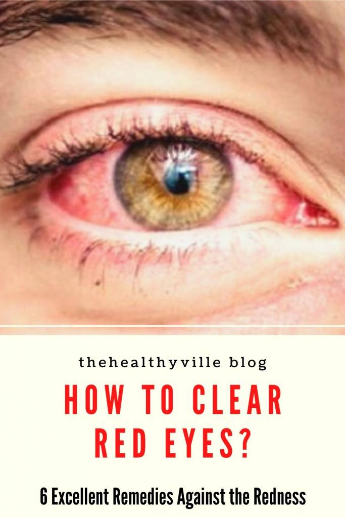 How to Clear Red Eyes_ – 6 Excellent Remedies Against the Redness