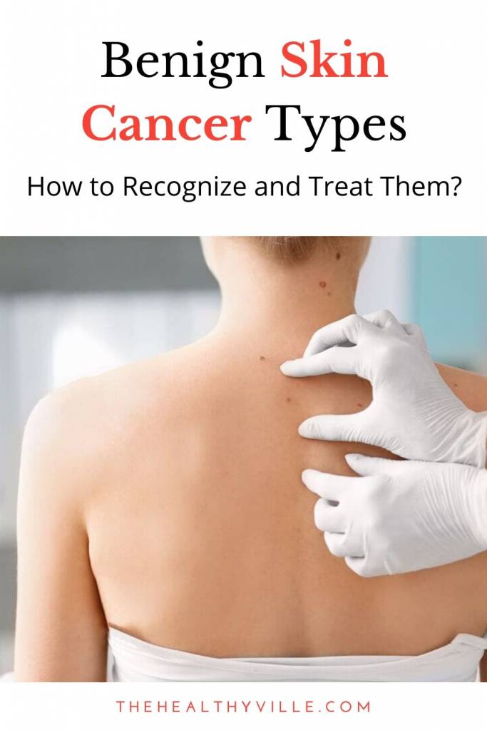 Benign Skin Cancer Types – How to Recognize and Treat Them_