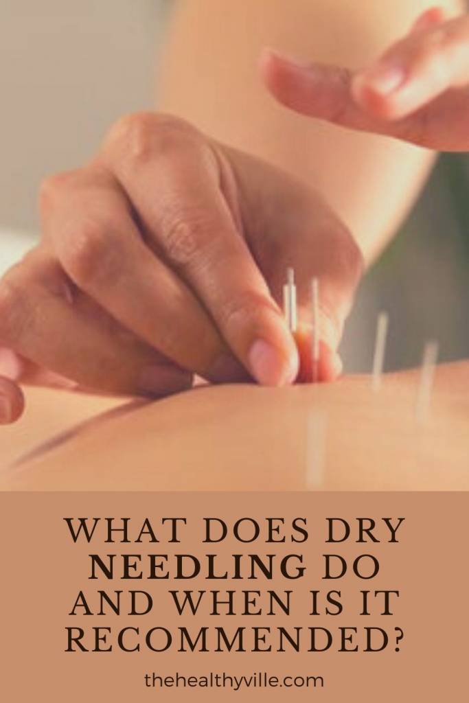 What Does Dry Needling Do and When Is It Recommended_