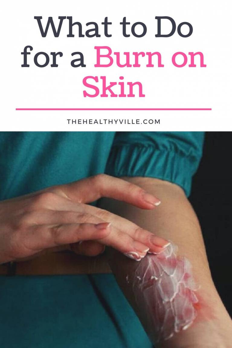 What To Do For A Burn On Skin And What To Avoid Useful Advice
