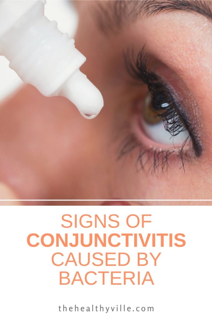 Signs of Conjunctivitis Caused by Bacteria – Recognize Them on Time!