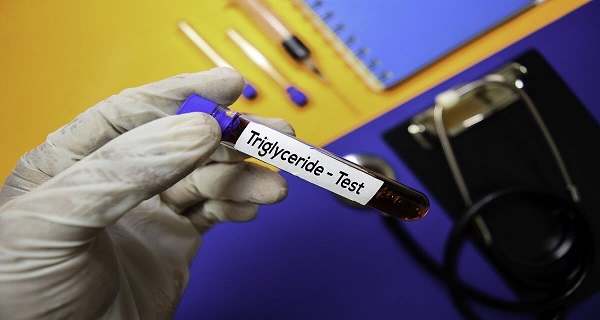 triglyceride levels