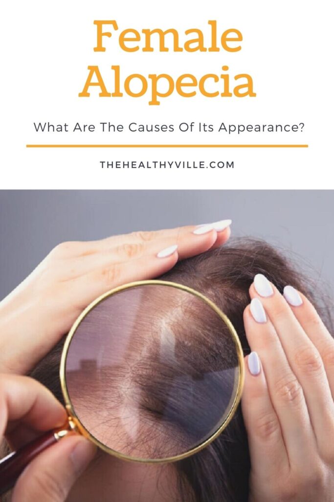 Female Alopecia - What Are The Causes Of Its Appearance_