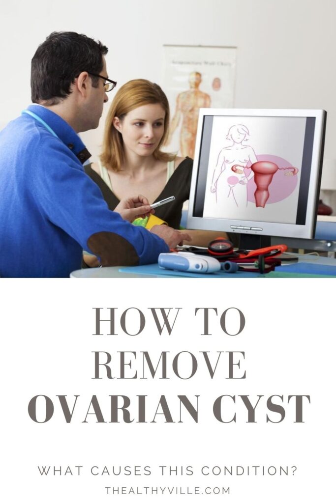 How to Remove Ovarian Cyst and What Causes This Condition_