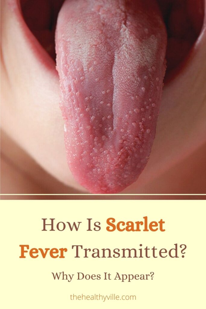 How Is Scarlet Fever Transmitted_ Why Does It Appear_