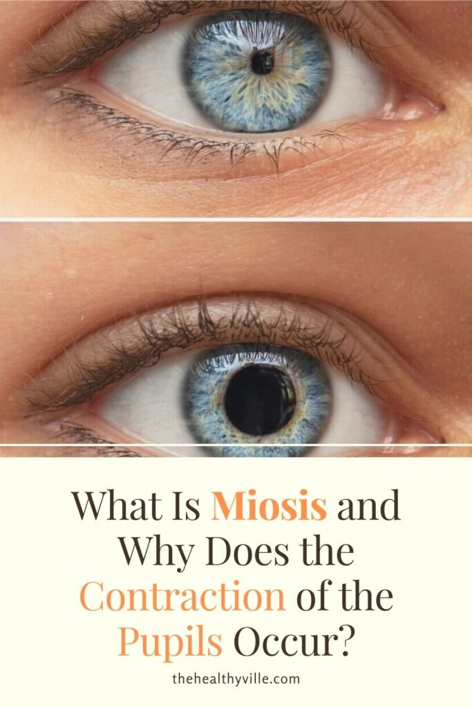 What Is Miosis and Why Does the Contraction of the Pupils Occur_