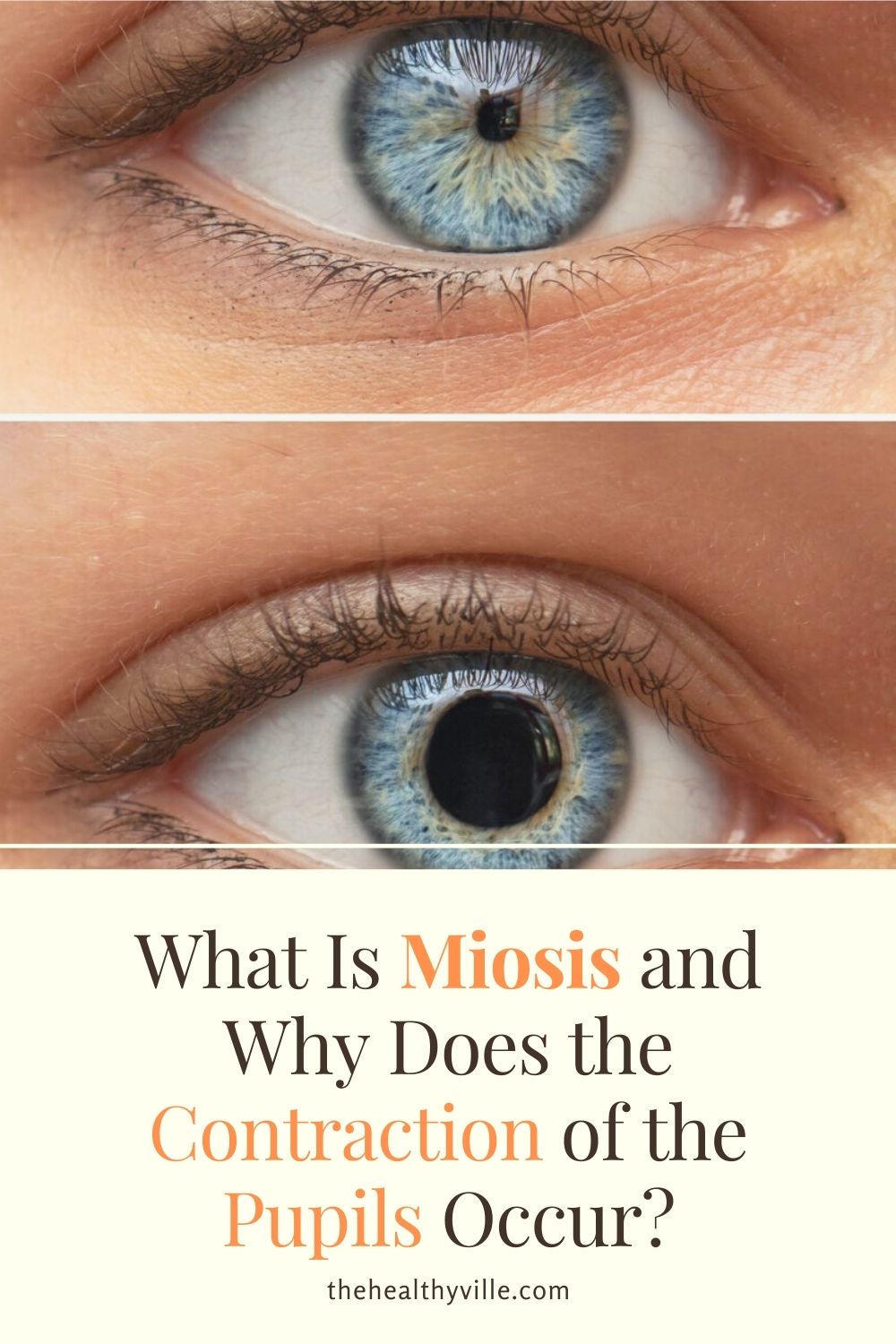 Miosis Definition