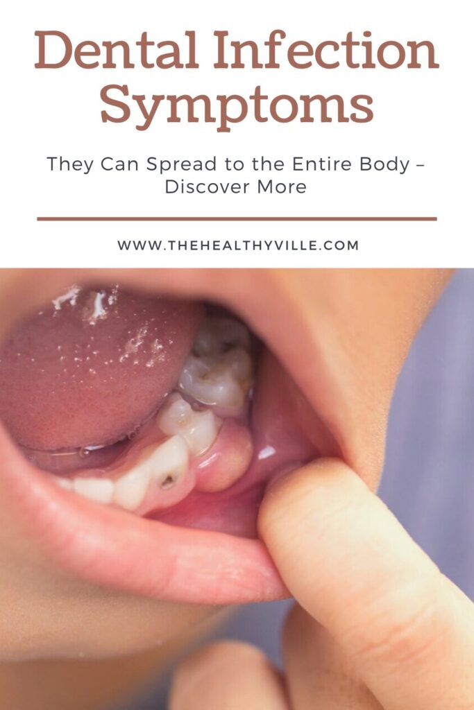 Dental Infection Symptoms Can Spread to the Entire Body – Discover More