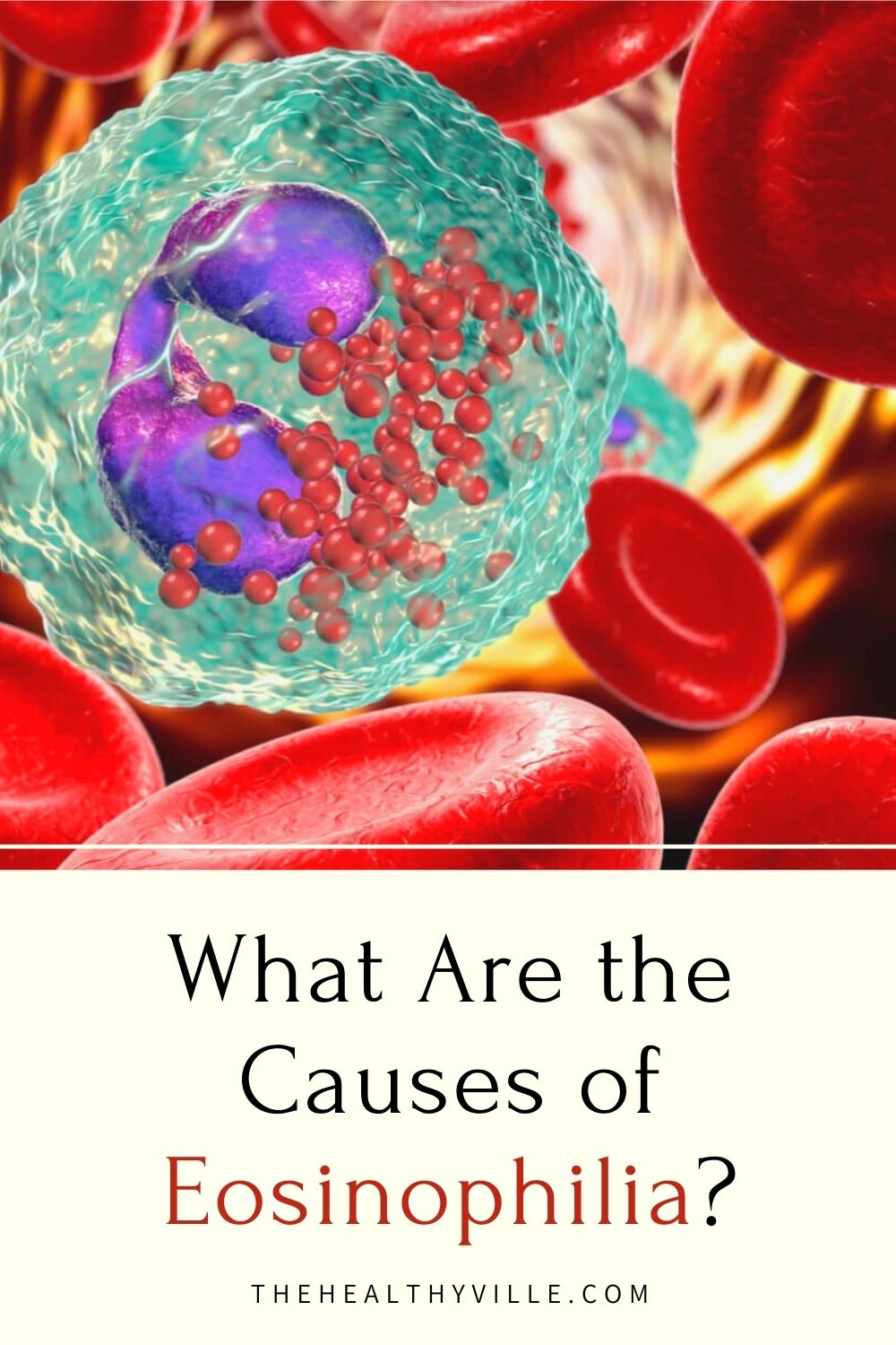 High Eosinophils Causes And Symptoms