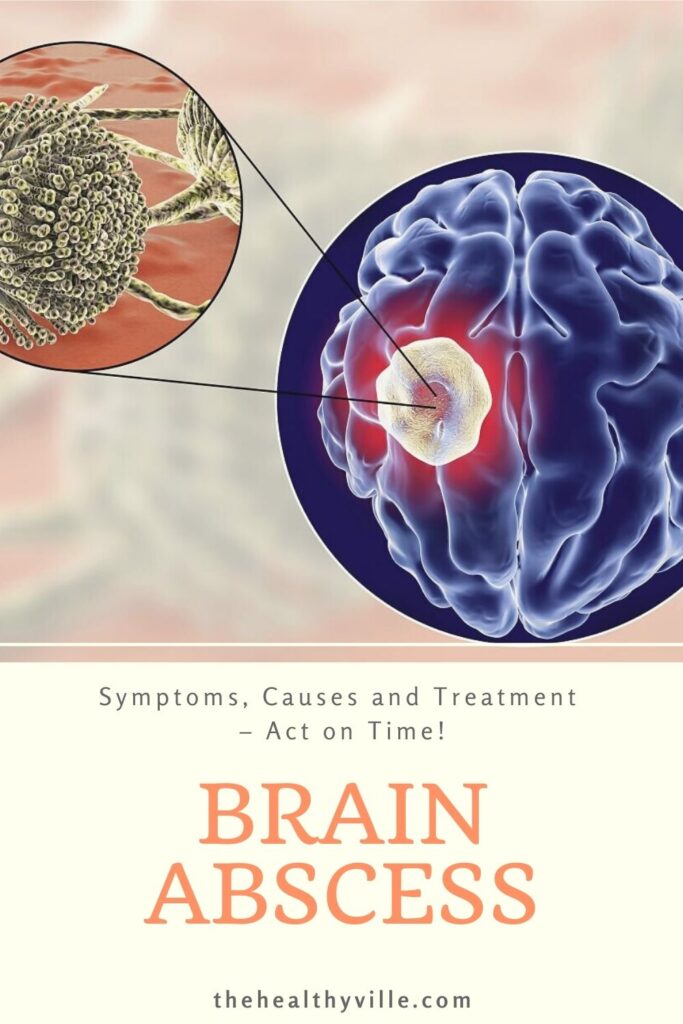 Brain Abscess Symptoms, Causes and Treatment – Act on Time!