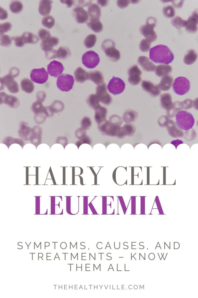Hairy Cell Leukemia Symptoms, Causes, and Treatments – Know Them All