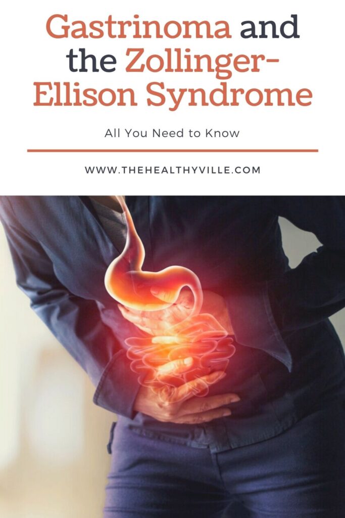 Gastrinoma and the Zollinger-Ellison Syndrome – All You Need to Know