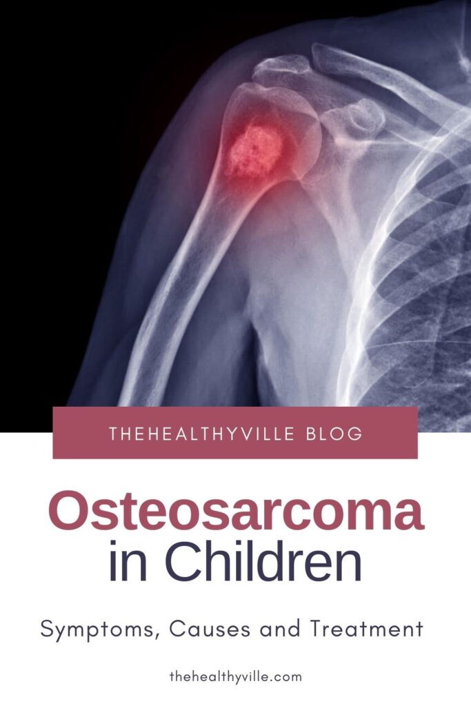 Osteosarcoma in Children_ Symptoms, Causes and Treatment