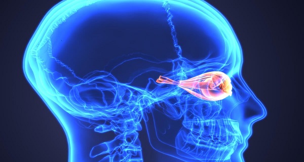 neuromyelitis optica