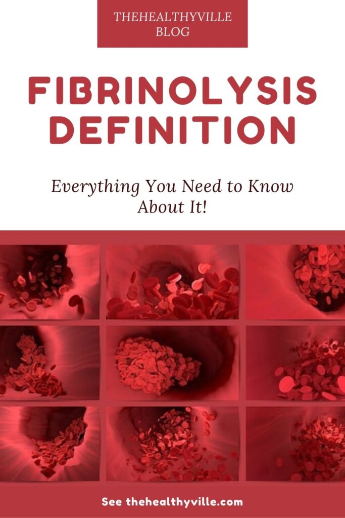 Fibrinolysis Definition – Everything You Need to Know About It!