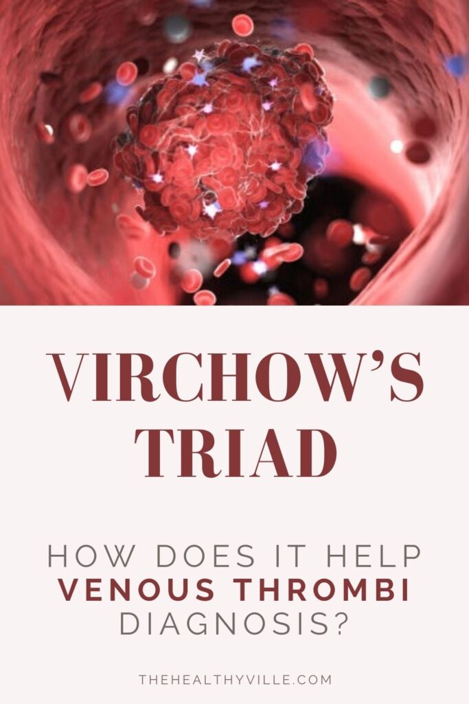 Virchow’s Triad – How Does It Help Venous Thrombi Diagnosis_