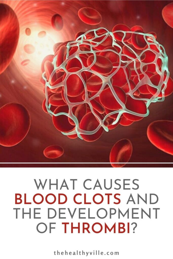 What Causes Blood Clots and the Development of Thrombi_
