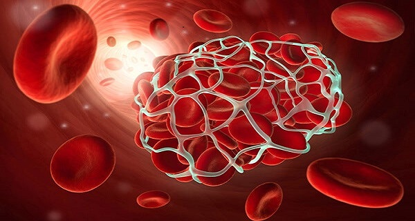 what causes blood clots