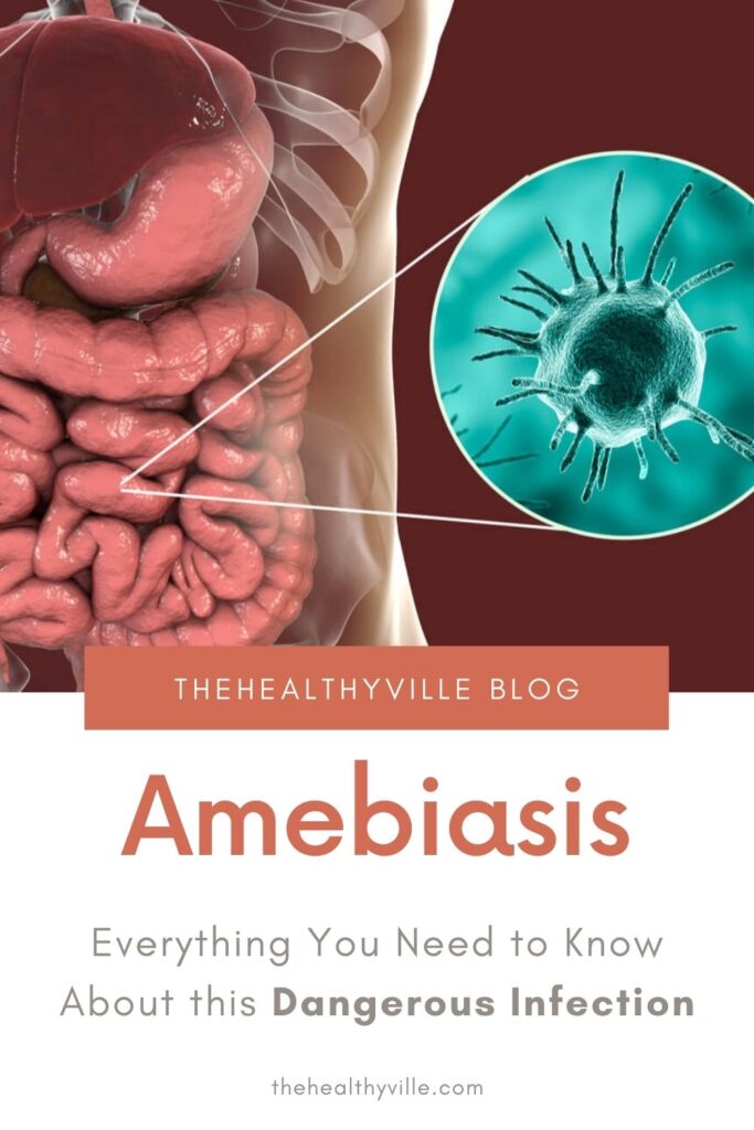 Amebiasis – Everything You Need to Know About this Dangerous Infection