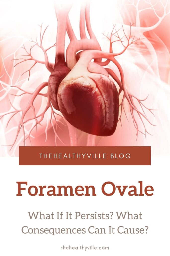 Foramen Ovale – What If It Persists What Consequences Can It Cause