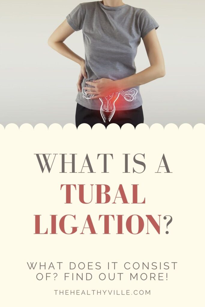 What Is a Tubal Ligation What Does It Consist Of Find Out More!