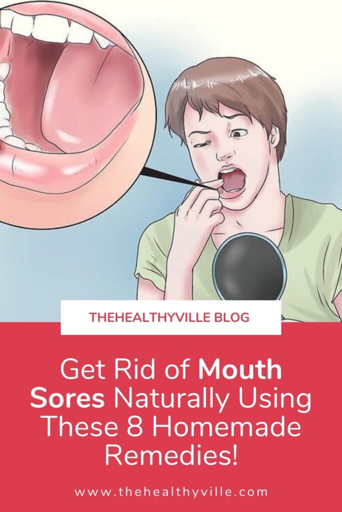Get Rid of Mouth Sores Naturally Using These 8 Homemade Remedies!