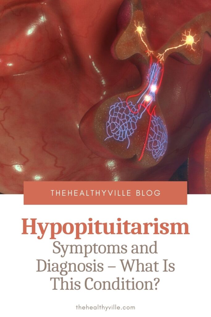 Hypopituitarism Symptoms and Diagnosis – What Is This Condition