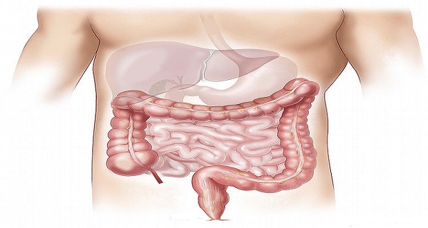 short bowel syndrome