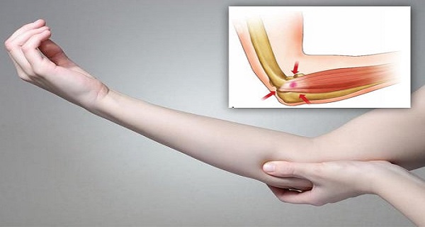 how to treat tennis elbow at home