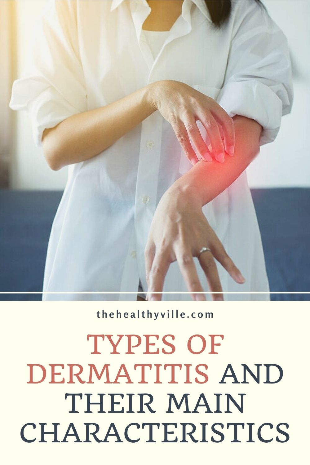 Different Types Of Dermatitis 3310