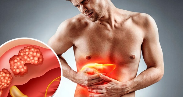 what are symptoms of liver cancer