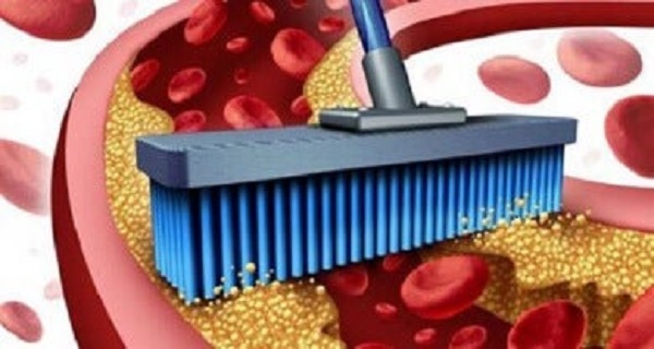 how to clean arteries