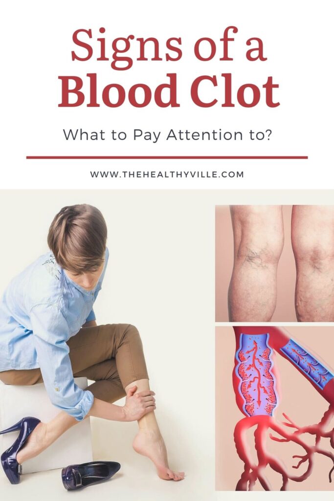 Signs of a Blood Clot – What to Pay Attention to