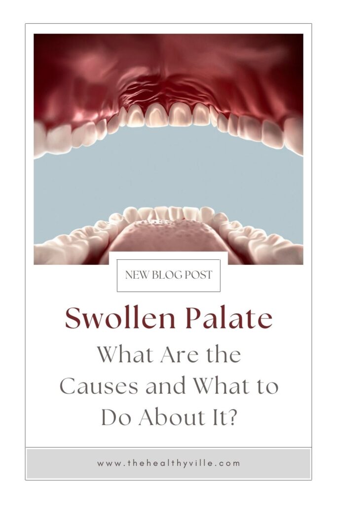 Swollen Palate – What Are the Causes and What to Do About It