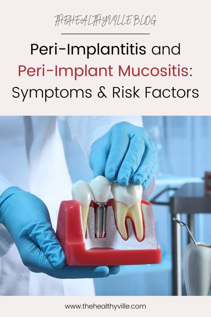 Peri-Implantitis and Peri-Implant Mucositis Symptoms & Risk Factors