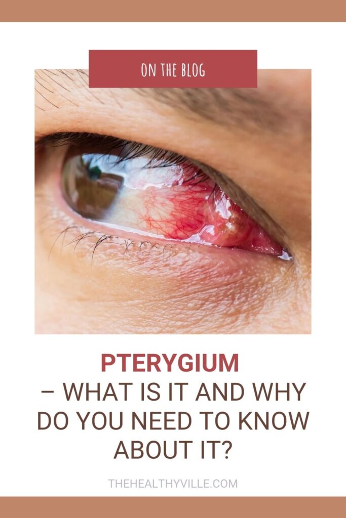 Pterygium – What Is It and Why Do You Need to Know About It