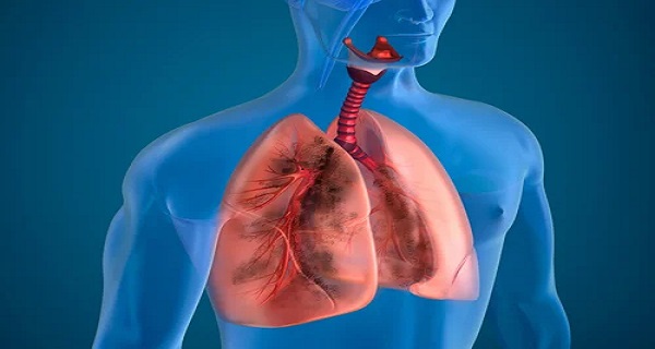 Lungs Purification for Smokers – 10 Ingredients that Work!