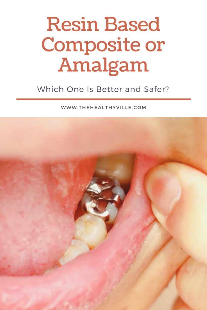 Resin Based Composite or Amalgam – Which One Is Better and Safer