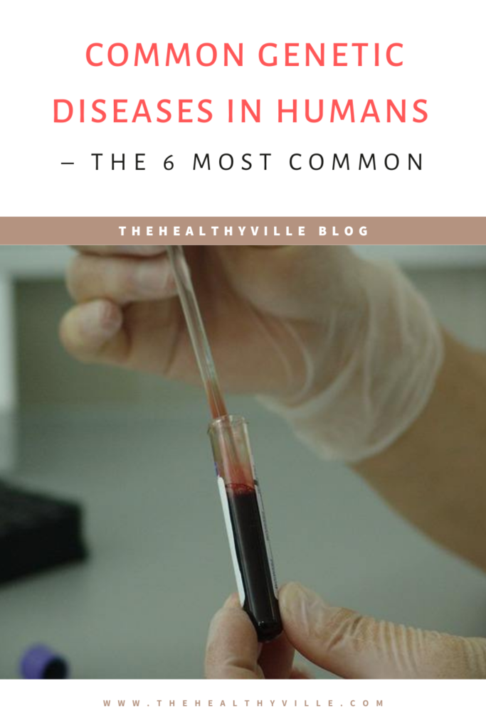 Common Genetic Diseases in Humans – The 6 Most Common