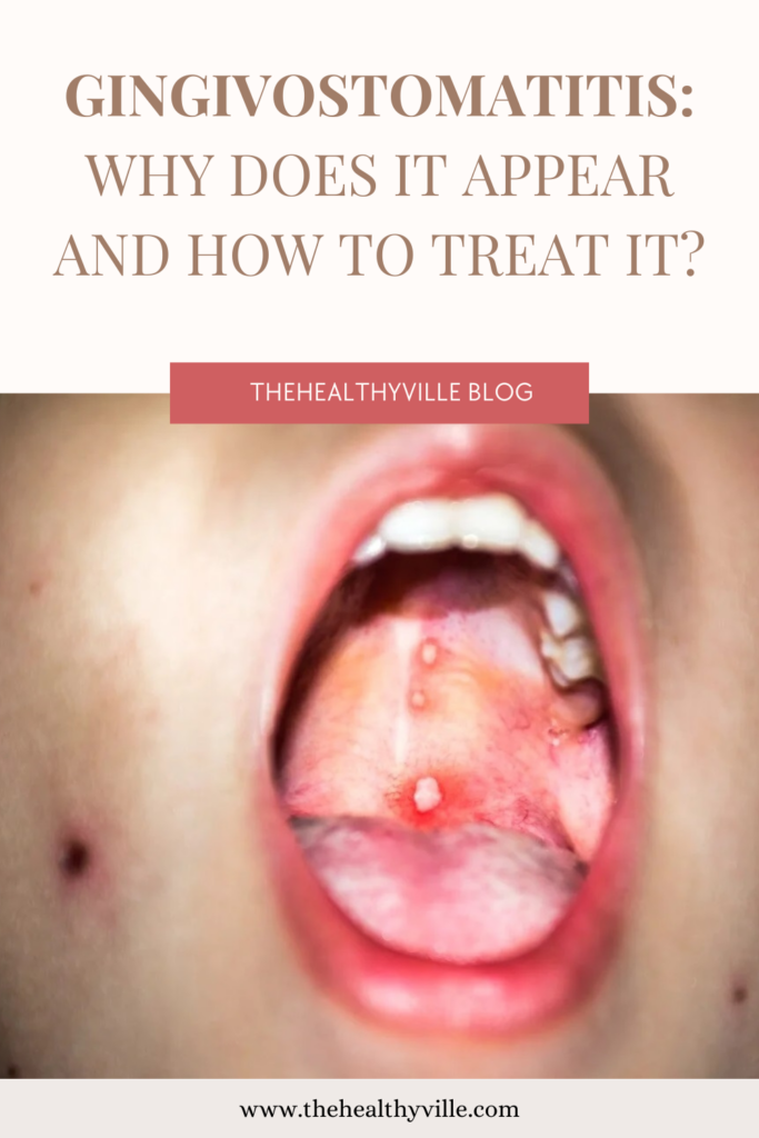 Gingivostomatitis Why Does It Appear and How to Treat It